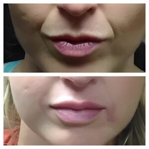 pic website aesth 2 300x300 1.jpg pic website aesth 2 300x300 1.jpg